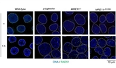 The MRE11 nuclease promotes homologous recombination not only in DNA double-strand break resection but also in post-resection in human TK6 cells