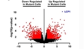 Lymphocyte cytosolic protein 1 (LCP1) is a novel TRAF3 dysregulation biomarker with potential prognostic value in multiple myeloma