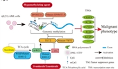 Aberrant DNA methylation in t(8;21) acute myeloid leukemia