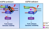 Defective replication stress response linked to microcephaly