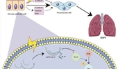 MiRNA let-7i promotes radiation-induced pulmonary epithelial-mesenchymal transition by targeting IL-10