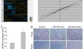 MiR-146a induces the aging of mesenchymal stem cell via CASK