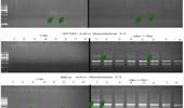 Genomic instability evaluation in different cell line by random amplified polymorphic DNA-PCR analysis