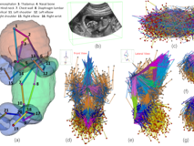 澳门博彩在线
倪东教授团队在《Medical Image Analysis》上发表文章