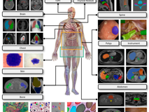 澳门博彩在线
倪东教授团队在《Medical Image Analysis》上发表文章